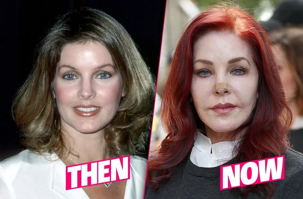 Priscilla Presley before and after