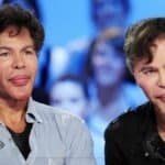 bogdanoff twins before surgery