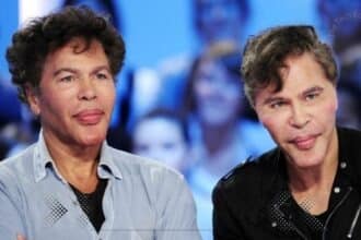 bogdanoff twins before surgery