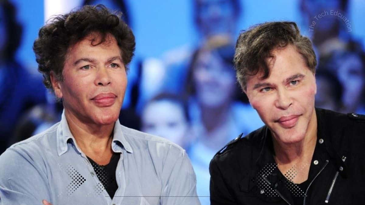 Bogdanoff Twins Before Surgery See How They Look!