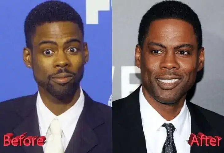 Chris Rock Nose Job