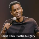 Chris Rock Plastic Surgery