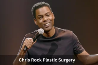Chris Rock Plastic Surgery
