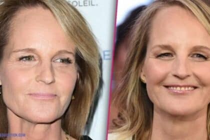 Helen Hunt Plastic Surgery