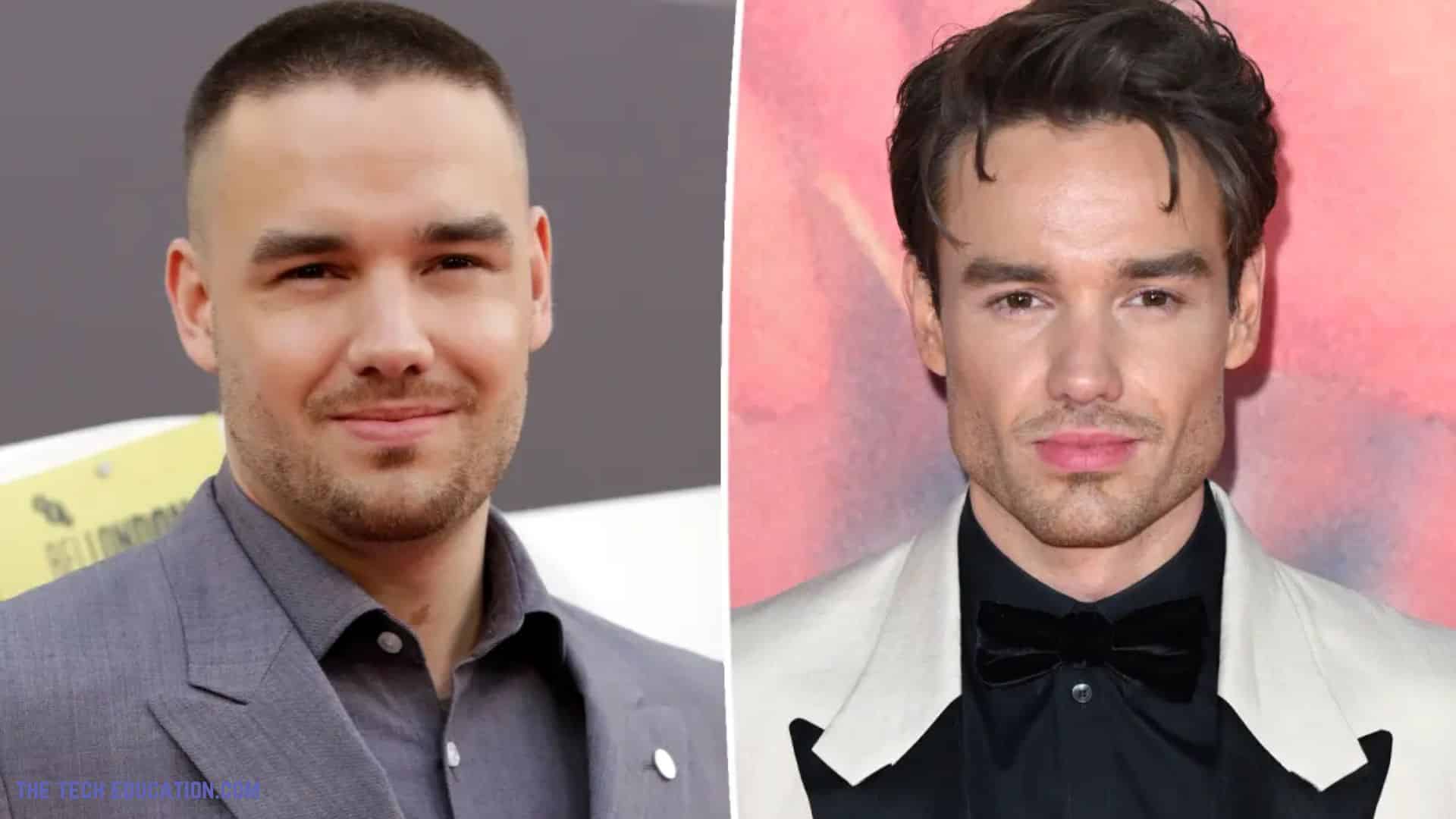 Did Liam Payne Get Plastic Surgery? His Before And After Pic