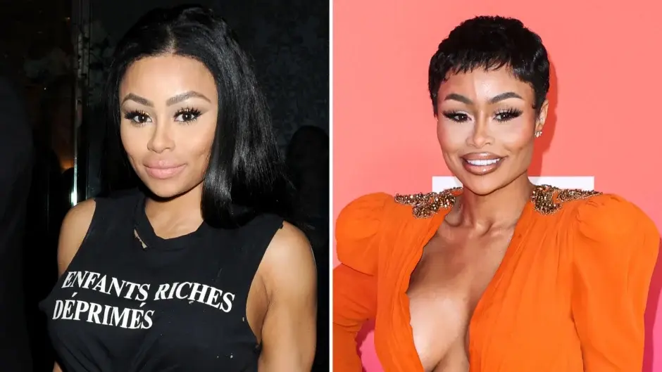 blac chyna before and after