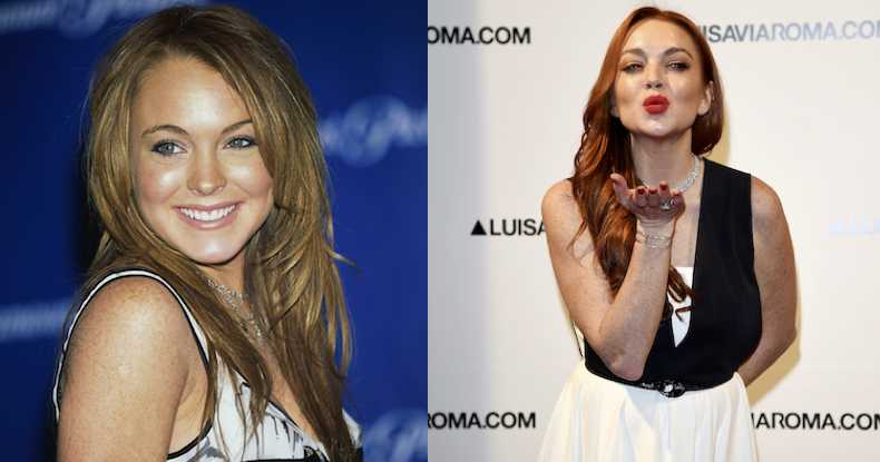 lindsay lohan before and after