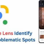How does Google Lens Identify Problematic Skin Spots