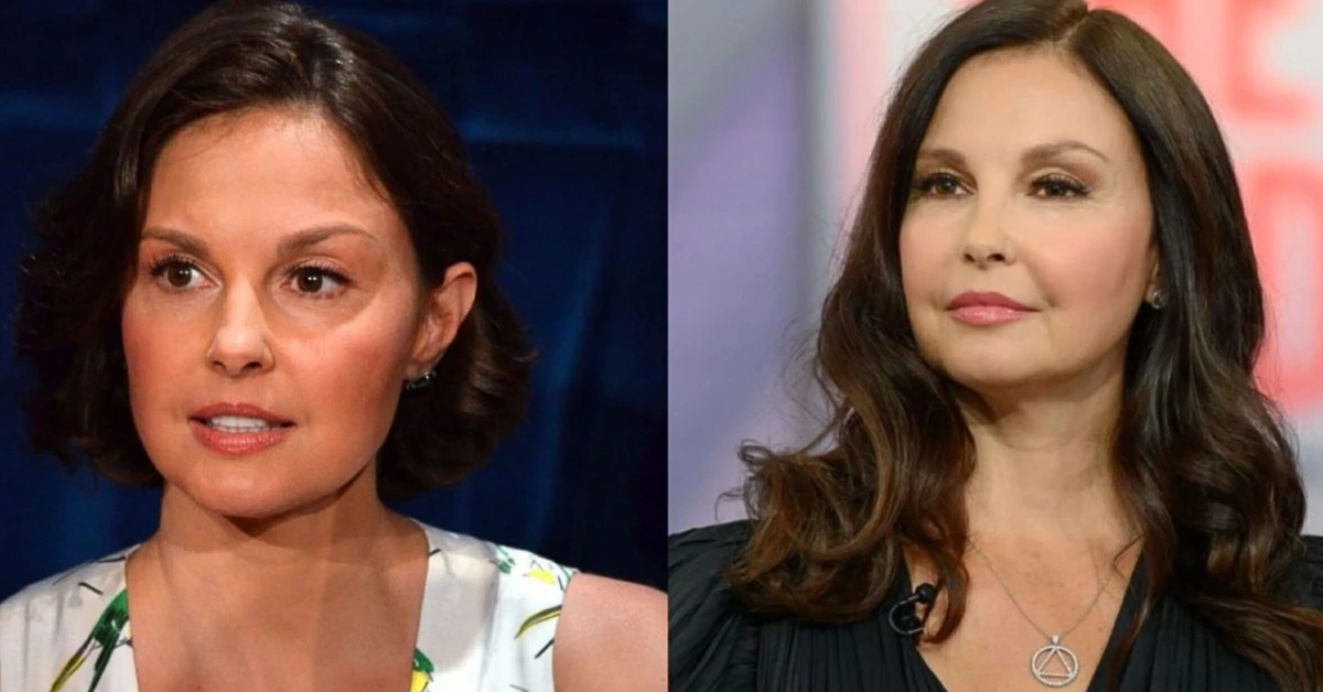 Ashley Judd Plastic Surgery