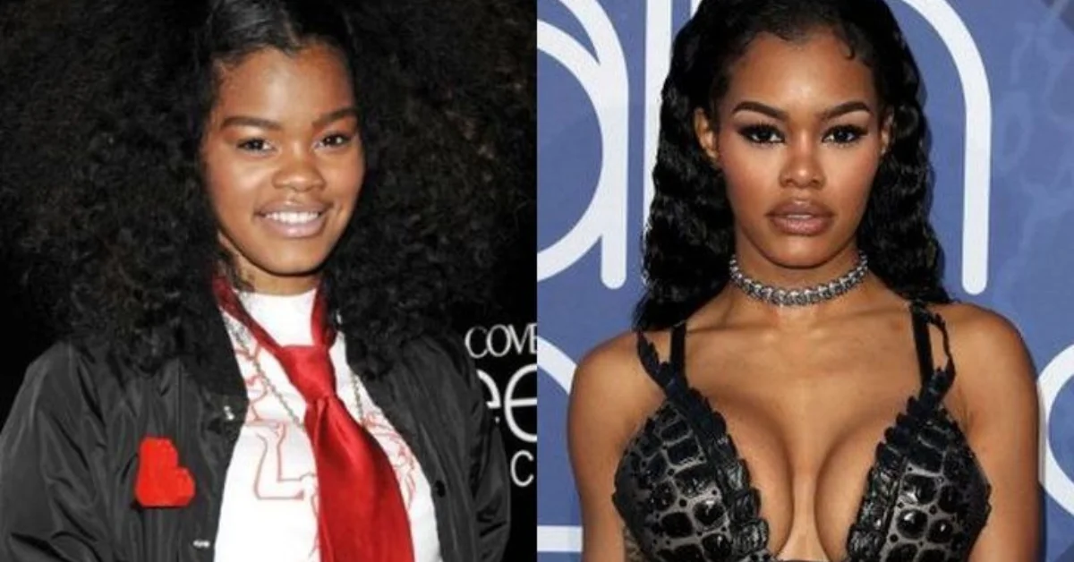 Teyana Taylor Plastic Surgery