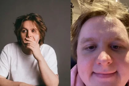 Lewis Capaldi Weight Gain