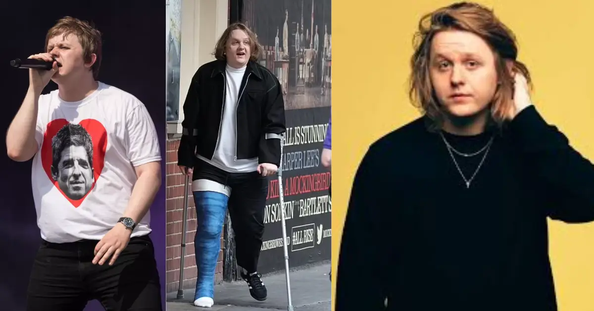 Lewis Capaldi Weight Gain