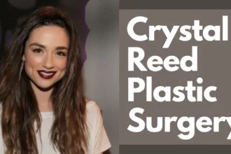 Crystal Reed Plastic Surgery