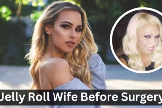 Jelly Roll Wife Before Surgery