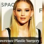 _Jennifer Lawrence Plastic Surgery