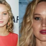 Jennifer Lawrence Plastic Surgery