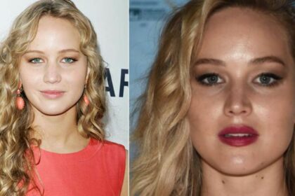 Jennifer Lawrence Plastic Surgery