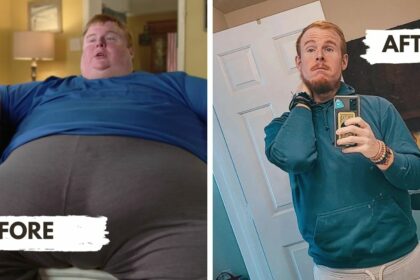 Casey King Weight Loss