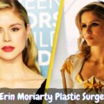 Erin Moriarty Plastic Surgery