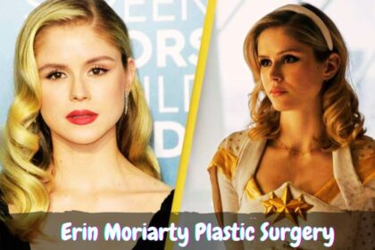 Erin Moriarty Plastic Surgery