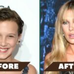 Millie Bobby Brown Plastic Surgery