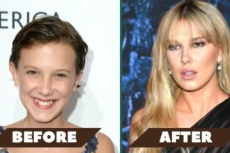 Millie Bobby Brown Plastic Surgery
