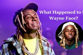 What Happened to Lil Wayne Face?