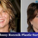 Johnny Rzeznik Plastic Surgery