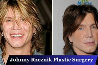 Johnny Rzeznik Plastic Surgery