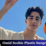 Omid Scobie Plastic Surgery