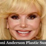 Loni Anderson Plastic Surgery