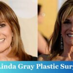 Linda Gray Plastic Surgery