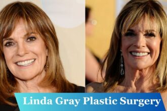 Linda Gray Plastic Surgery