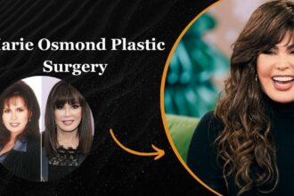 Marie Osmond Plastic Surgery
