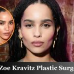 Zoe Kravitz Plastic Surgery