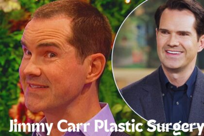 Jimmy Carr Plastic Surgery