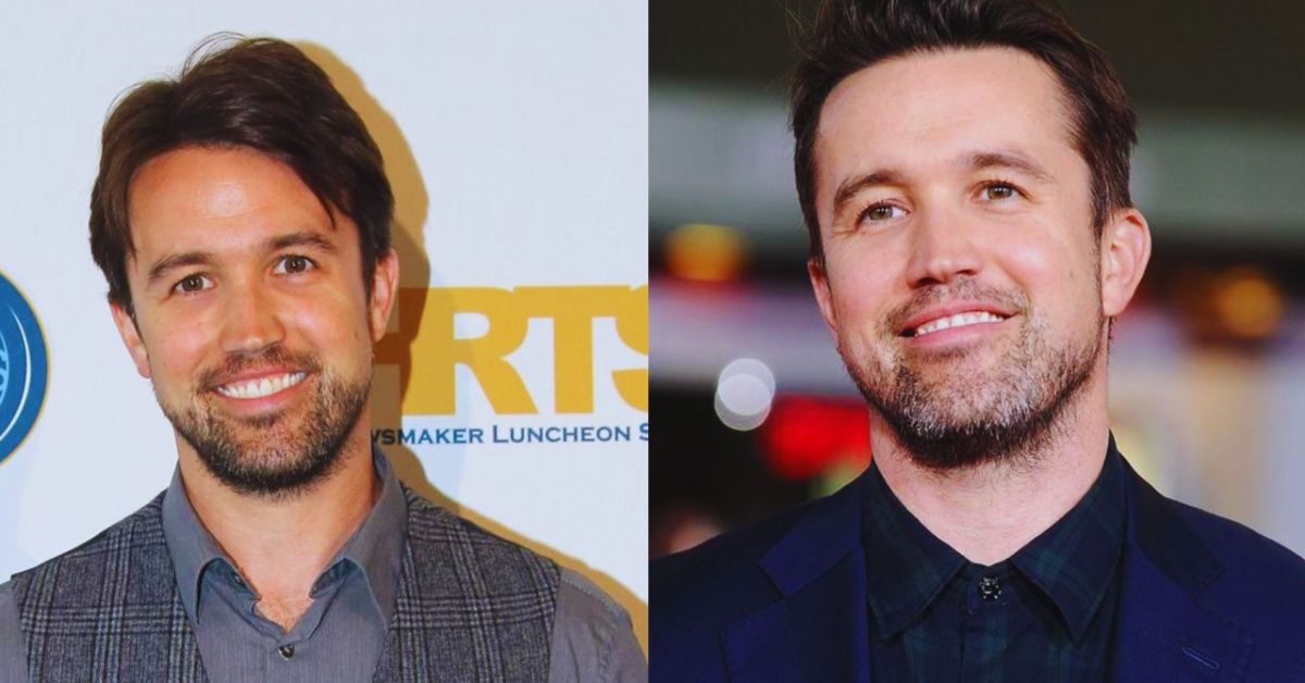 Rob Mcelhenney Plastic Surgery