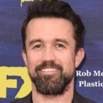 Rob Mcelhenney Plastic Surgery