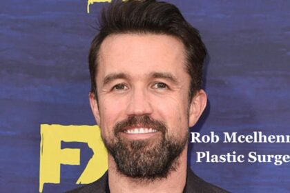 Rob Mcelhenney Plastic Surgery