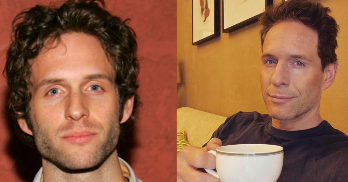 Glenn Howerton Plastic Surgery