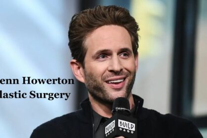 Glenn Howerton Plastic Surgery