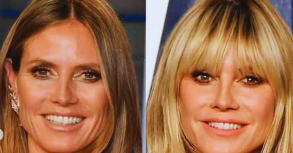 Heidi Klum Plastic Surgery