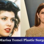 Marisa Tomei Plastic Surgery