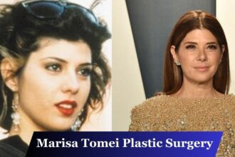 Marisa Tomei Plastic Surgery