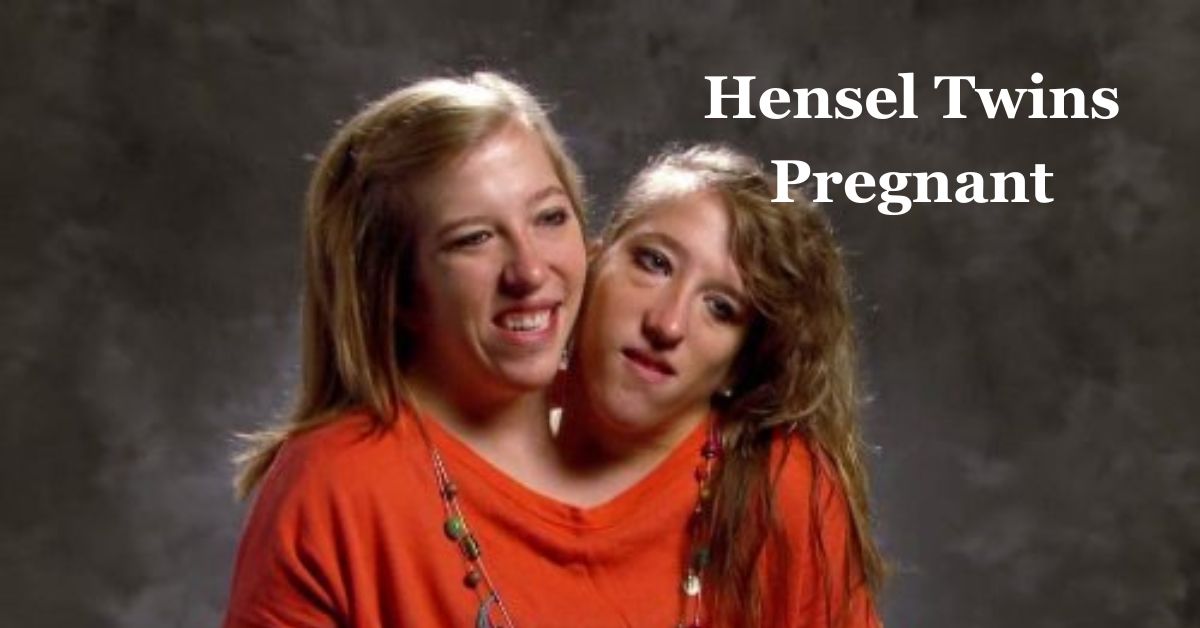 Abby And Brittany Hensel Pregnancy An Unprecedented Medical Marvel